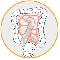 TissueSealAp1 TissueSealAp1