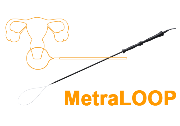 metraloop_1
